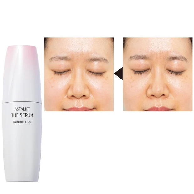 頑固なシミ・そばかすを消したい！ 即効性を実感した受賞コスメ・アスタリフ…