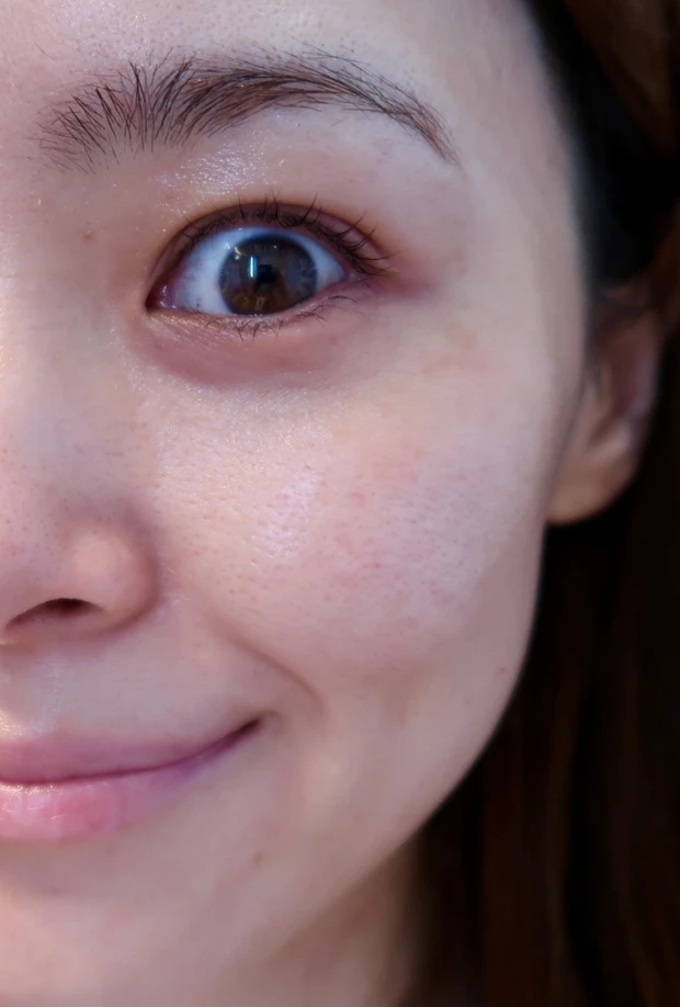 【ドクターズコスメを組み合わせた超美白ケア】_10_1