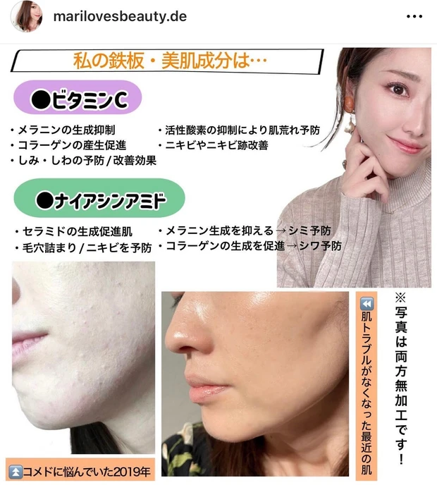 シワと戦うあなたへ♡国が認めたシワ改善成分・ナイアシンアミド配合のアンチエイジング美容液がすごかった・・・!_3_1