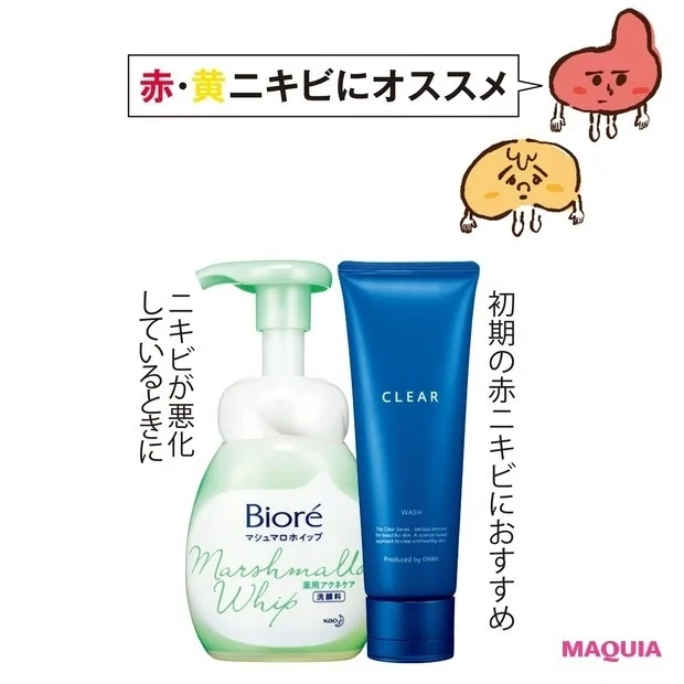 大人のニキビケアのポイント_1. 洗浄_赤・黄ニキビにおすすめの洗顔料