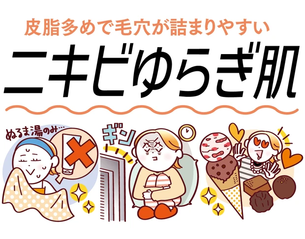 【ニキビゆらぎ肌】糖質の摂りすぎ、睡眠不足が影響！注意点＆おすすめのスキンケアを紹介