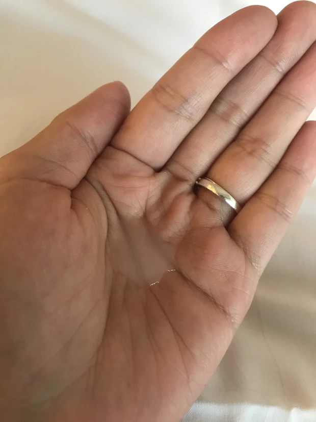 あのヒルドイドがとうとう薬局で?!_2