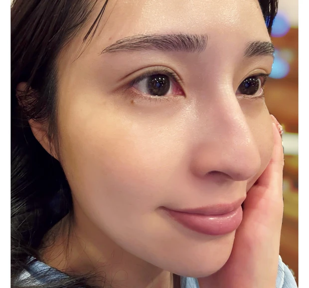 2026年3月4月 おすすめ最新作コスメ 3月25日(水)発売 ダーマレーザー スーパーブラックVC 使用感