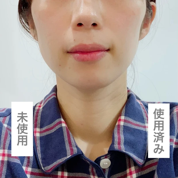 実力は本物！Refaカッサレイでリフトアップ_2_2