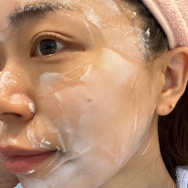 【韓国美容医療②】シロアムクリニックで肌管理！ドクターおまかせコースでポテンツァ＆シュリンク体験レポ。_7_2