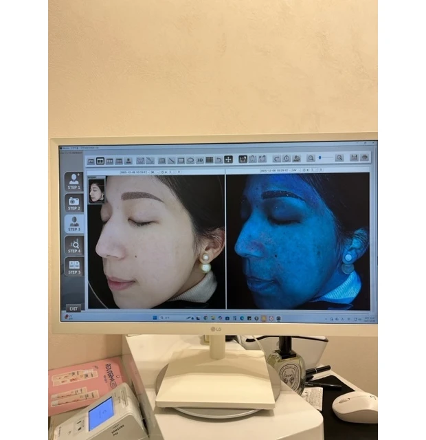 【韓国美容】韓国旅行で行ったクリニックをご紹介♡大満足の施術は...?_2