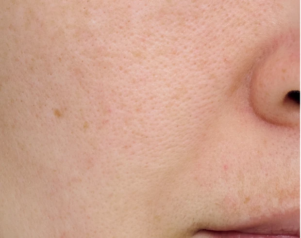 【悩み別】毛穴を目立たなくする方法 PhotoGallery_1_36