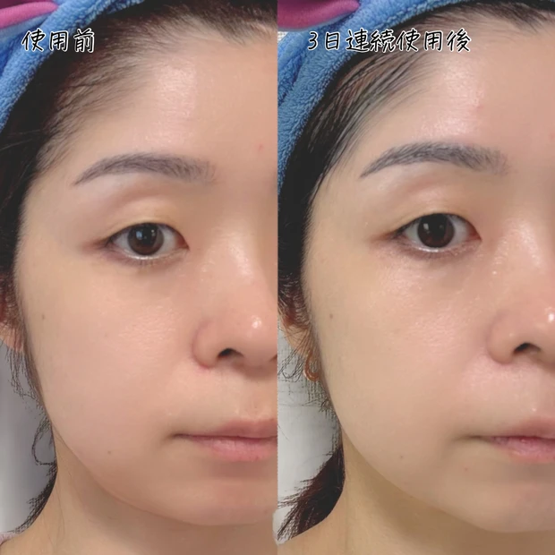 【小田切ヒロさん愛用】SISI AWAスパークリングパックをレビュー｜5分で透明感ケアできる炭酸パック_7