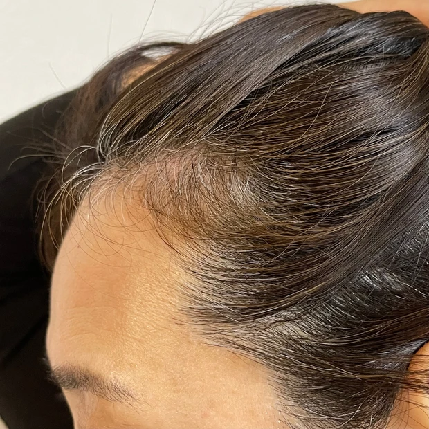 LPLP(ルプルプ)の【白髪染がめできるトリートメント】実際どうなの！？生え際のしぶとい白髪に使ってみた。_1_1