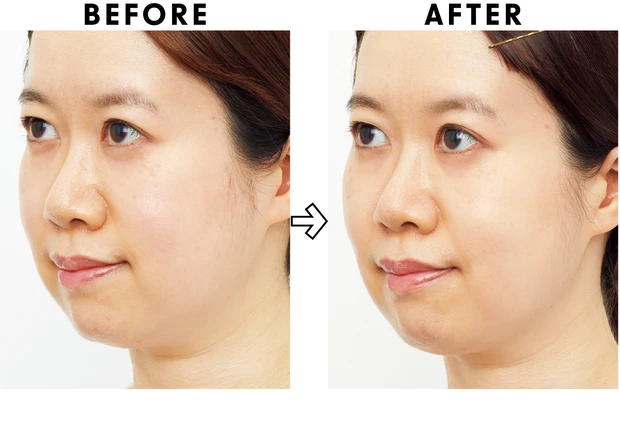 高額スキンケアの効果は？ ベスコス受賞コスメを2週間お試し PhotoGallery_1_14