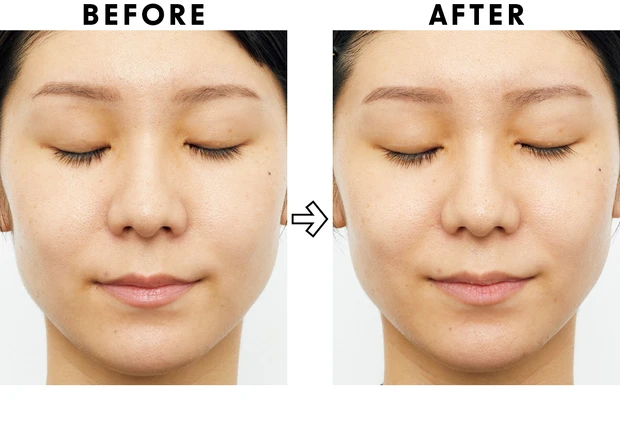 高額スキンケアの効果は？ ベスコス受賞コスメを2週間お試し PhotoGallery_1_10