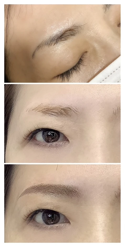 アヴェニュークリニック アートメイク アイブロウ症例写真3