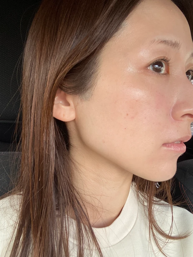 DT中のノーファンデ肌におすすめの愛用アイテム3選!無加工画像でリアルにお届けします!_3