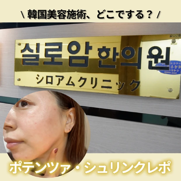【韓国美容医療②】シロアムクリニックで肌管理！ドクターおまかせコースでポテンツァ＆シュリンク体験レポ。
