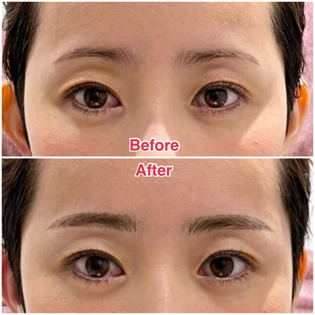 銀座レジーナクリニックおすすめ眉毛アートメイク施術内容レポ！値段は安い？MRI入れる？口コミブログ_14_1