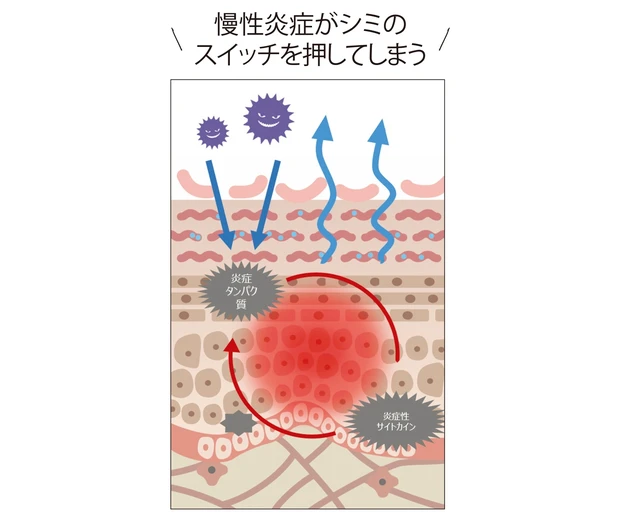 慢性炎症がシミの スイッチを押してしまう