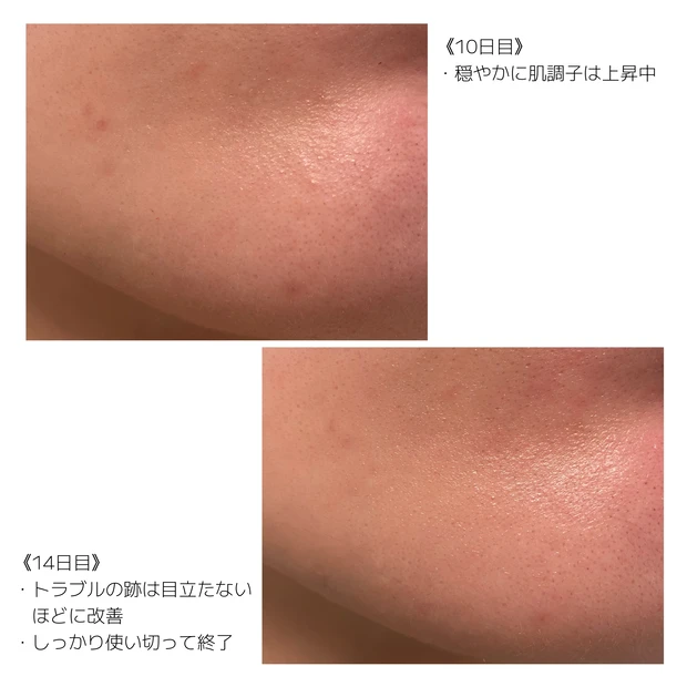 【リアルレポ】突如ゆらいだ肌に、アユーラの集中美容液を使ってみた話_8