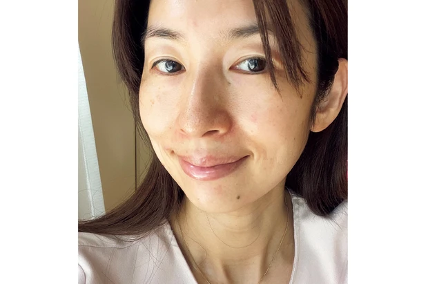 高額スキンケアの効果は？ ベスコス受賞コスメを2週間お試し PhotoGallery_1_18