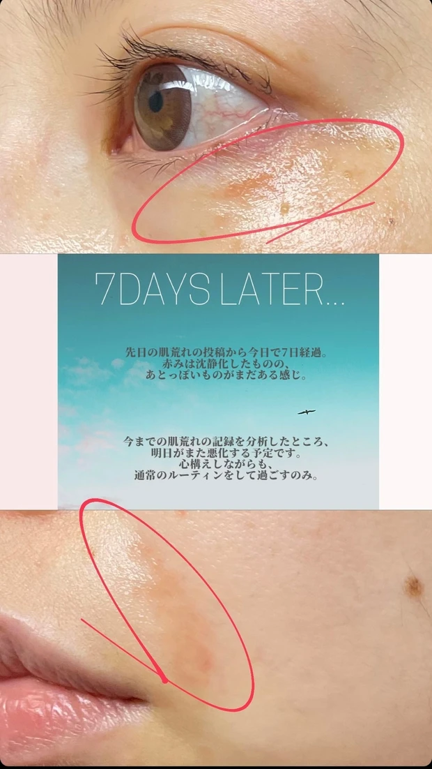 【Who is beki?】5年目ブロガーbekiが目指すは『カラダの中からキレイな人』づくり♡_4