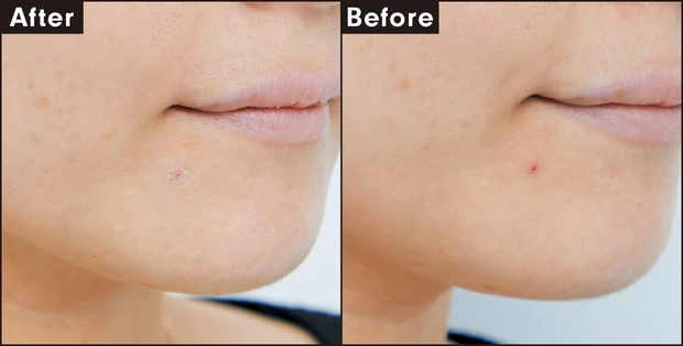 アディクション スキンリフレクト カラー コレクター 004 Calm Mint カバー力を検証