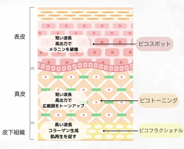 【美容医療】美容カウンセラーが教えるシミ取り治療!_3