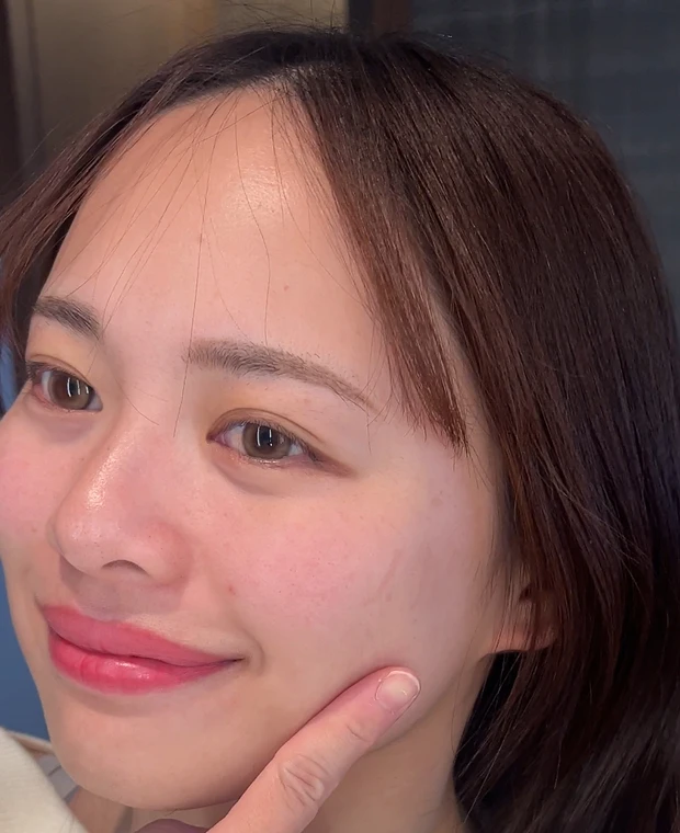 【必見】2024年やってよかった美容♡美容医療・ホームケア・美顔器、効果があったのはコレ！_2