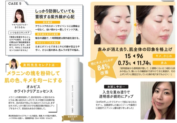 オルビス ホワイトクリアエッセンスの美白効果を実感