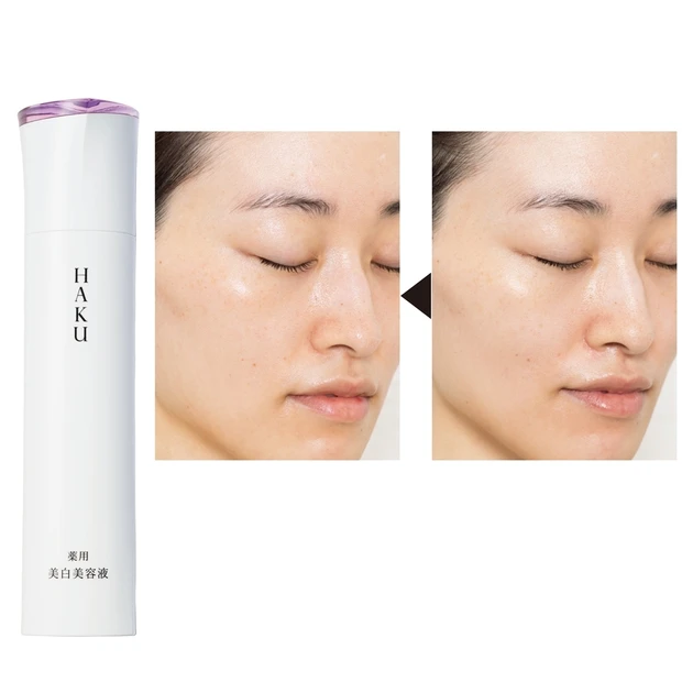 シミ・そばかすを薄くしたい！ 受賞コスメ・ＨＡＫＵの3週間お試しレポート