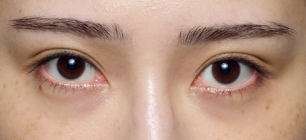 紫ぐまタイプのくまカバー＆涙袋メイクのテクニック ビフォー