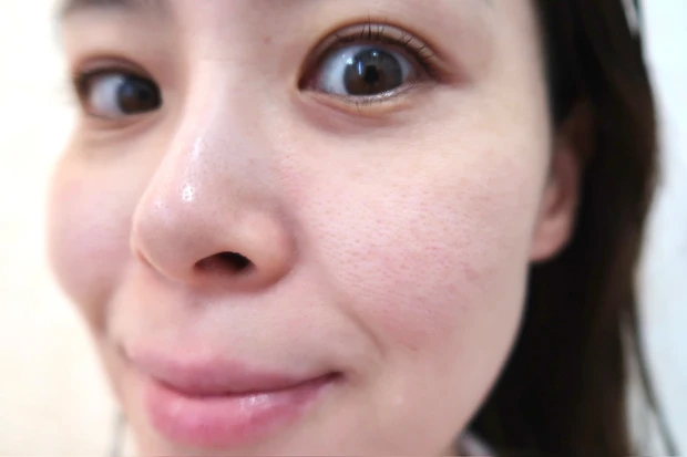 【超美白内服】私の肌は内服で作る！_6_2