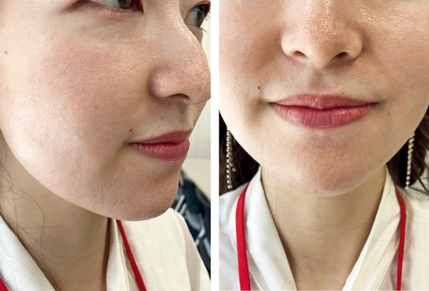 マキア　毛穴　皮脂　スキンケア　肌の状態