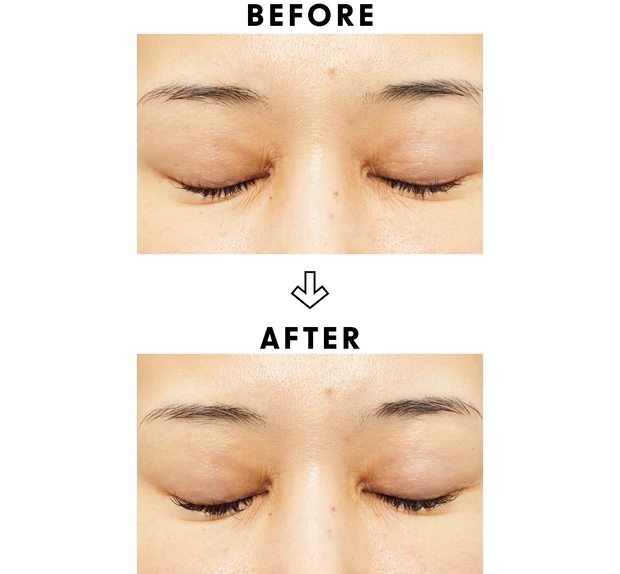 高額スキンケアの効果は？ ベスコス受賞コスメを2週間お試し PhotoGallery_1_21