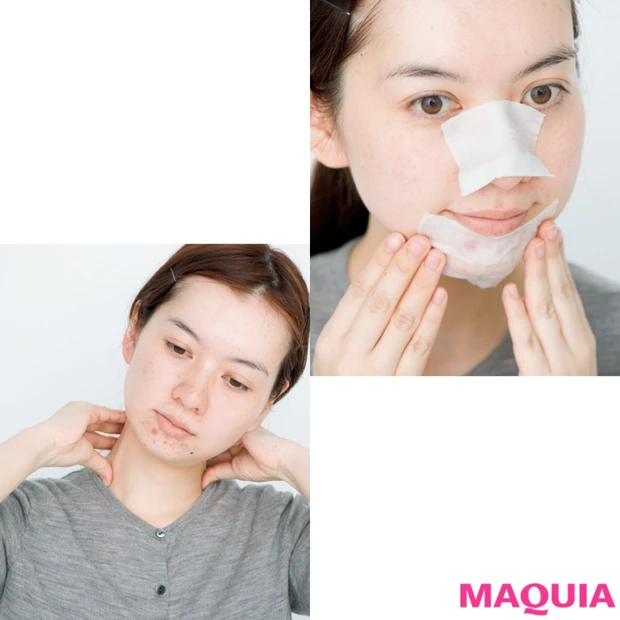 水井真理子さんが徹底指導! 繰り返すニキビは「お手入れグセ」が原因!?