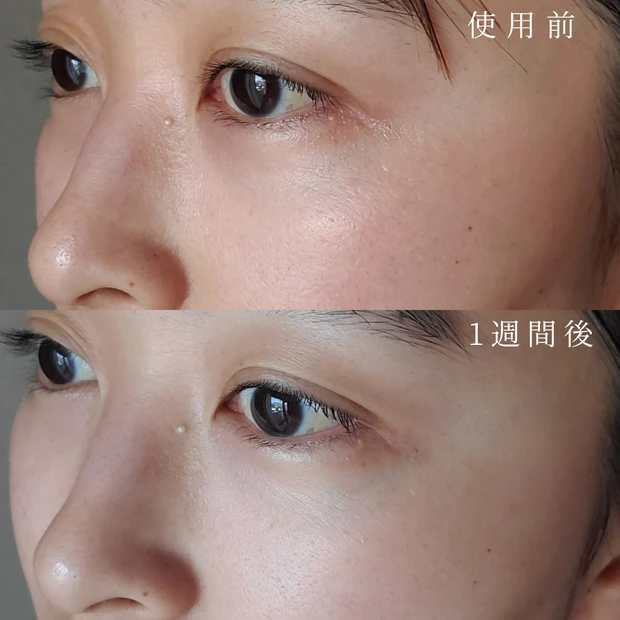 ファンケル 泥ジェル洗顔 効果