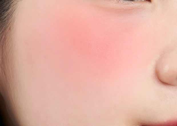 RD03 アンビシャス チーク