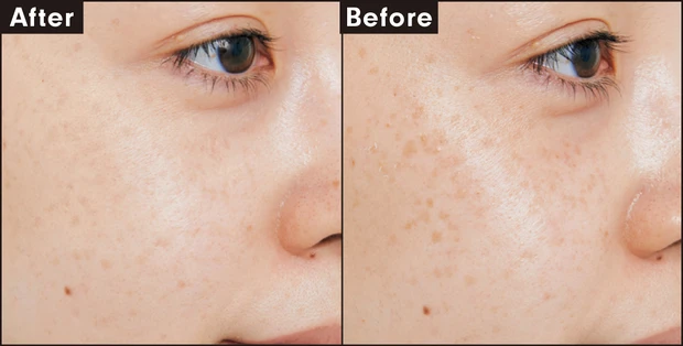 インウイ コンシーラー 01 カバー力を検証