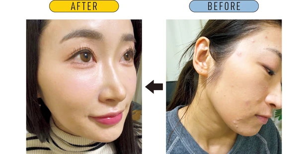 漫画で読める美肌挽回ストーリー＆おすすめコスメ PhotoGallery_2_3