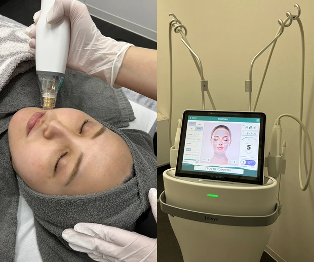 マキア　角栓　毛穴ケア　ポテンツァ