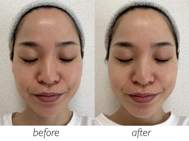 「ファインビジュアル バイタルコンディショニング ドットクリア」ビフォーアフター