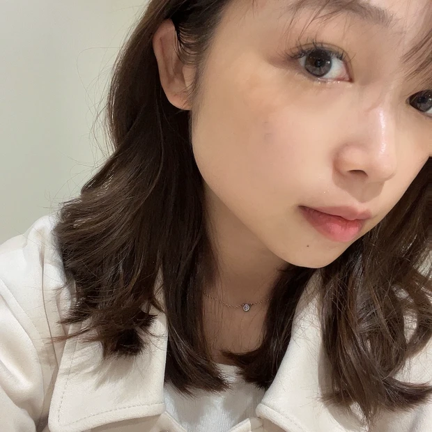 【渡韓レポ】韓国でハイフとエラボトックスして来ました（月１回×２）！！痛みは？効果は？体験談をレポートします💓小顔になりたいか方必見です！！明洞のTHE CLIM Clinicに行ってきたよ_3_2