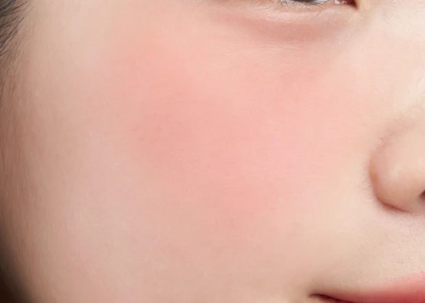 ND04 マイ チーク