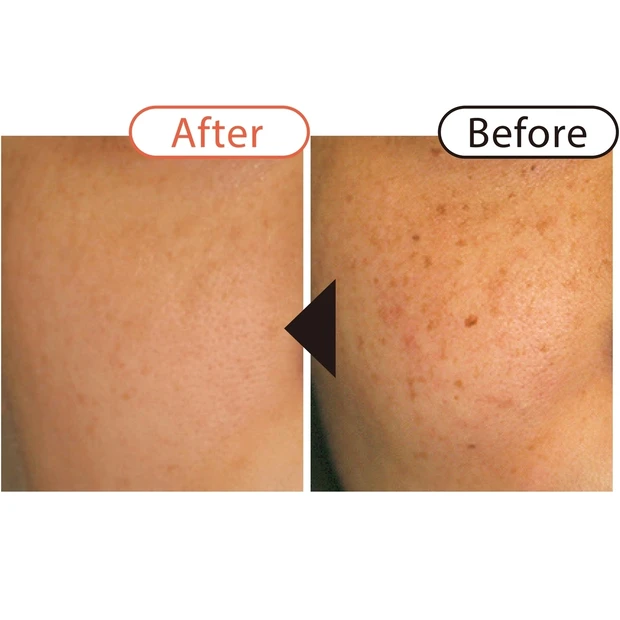 ドクターが回答! シミ・くすみ・肝斑・クマ……お悩み別に最適な「美容医療…