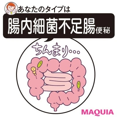 【便秘解消におすすめ】腸内細菌不足腸便秘タイプさん_腸内細菌の種類が少ない
