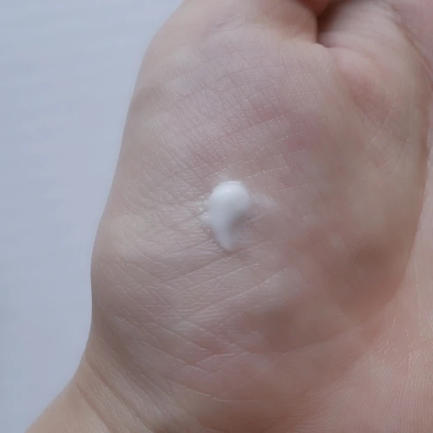 ニキビが大爆発した私のニキビケア_2_1