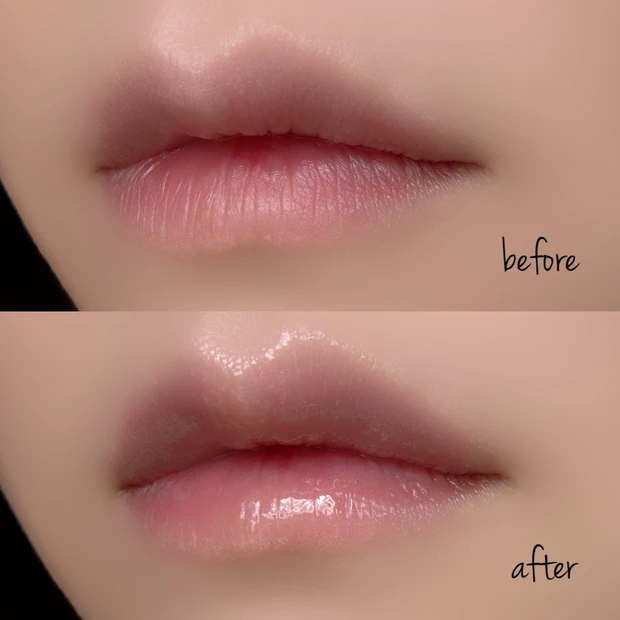 ObagiダーマパワーXリップエッセンスで乾き知らずのぷるぷる唇に_2_2