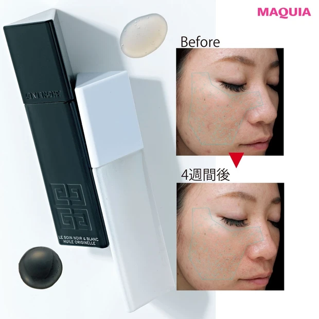 【ジバンシイ/エクサージュホワイト】24時間美白コスメをブロガーが4週間ガチお試し!