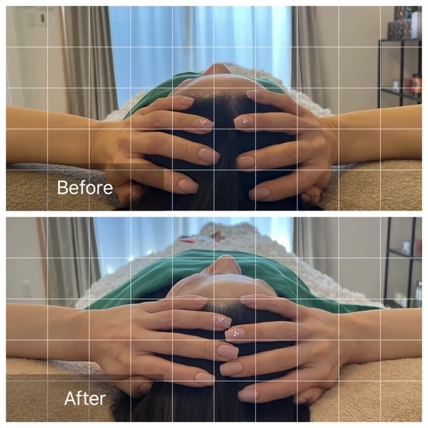 【この春美容医療デビュー】8年目マキアインフルエンサーbekiは今年もストイック目指します！_4