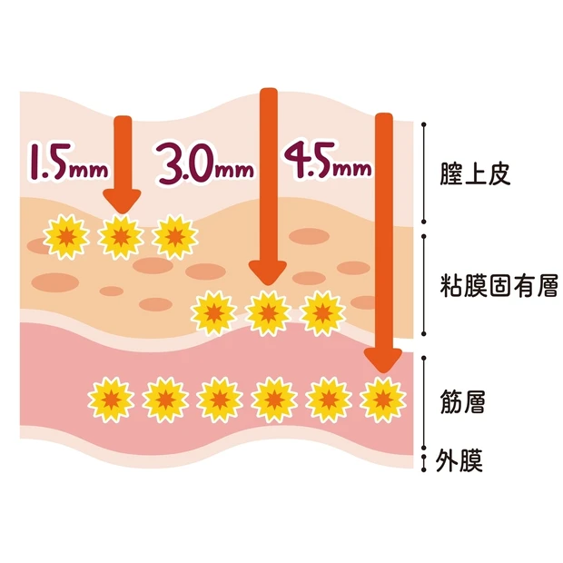 膣の引き締め、お尻のセルライトetc. ケアが難しい体のお悩みは「美容医…