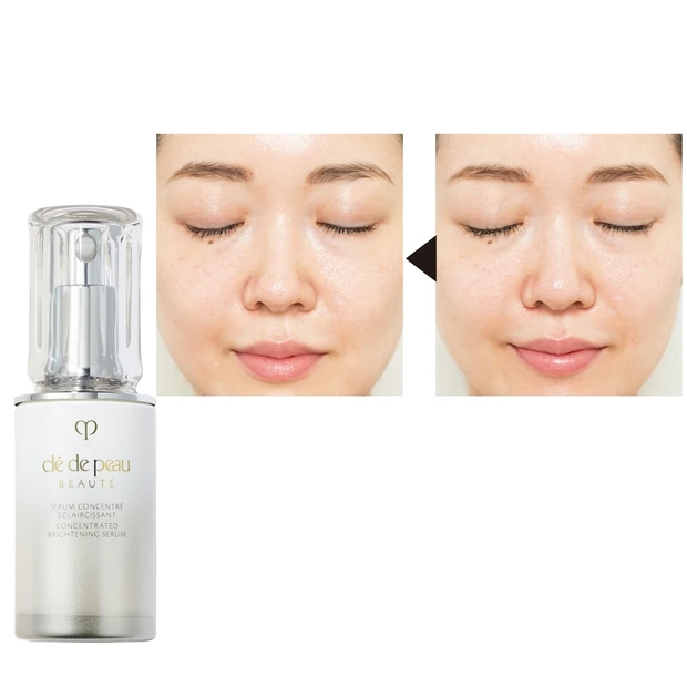 顔全体の黄ぐすみを改善したい！ 受賞コスメ「セラム コンサントレ エクレ…