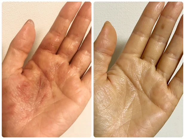 【飲む保湿ケア】チョコラBB®︎リッチ・セラミド10日間飲んでみました！！_4